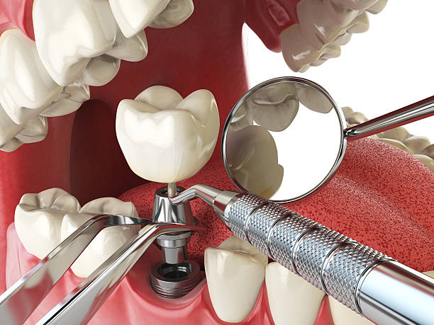Best Broken or Cracked Tooth Emergency Dentist in Kenner, LA